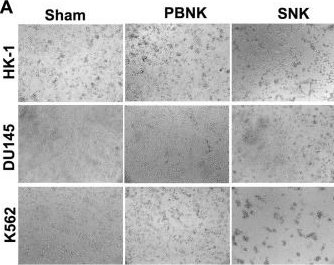 Fig.3.A from the publication: Antibody-Mediated In Vitro Activation and Expansion of Blood Donor-Derived Natural Killer Cells with Transient Anti-Tumor Efficacy.
