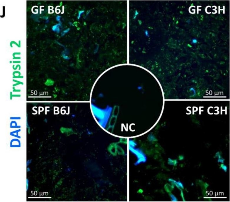 Fig.6.J showing Immunohistochemistry-immunofluorescence in a Mus musculus (House mouse) sample from the publication: The Genetic Background Is Shaping Cecal Enlargement in the Absence of Intestinal Microbiota.