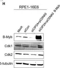 Fig.5.H showing Western Blotting from the publication: CIP2A facilitates the G1/S cell cycle transition via B-Myb in human papillomavirus 16 oncoprotein E6-expressing cells.