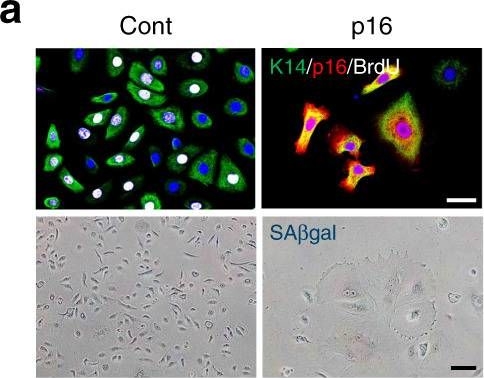 Chronic expression of p16INK4a in the epidermis induces Wnt-mediated hyperplasia and promotes tumor initiation.