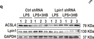 Fig.7.Q showing Western Blotting in a Mus musculus (House mouse) sample from the publication: Time-restricted feeding protects against septic liver injury by reshaping gut microbiota and metabolite 3-hydroxybutyrate.