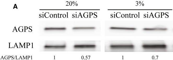 Fig.7.A showing Western Blotting in a Homo sapiens (Human) sample from the publication: Hypoxia enhances antibody-dependent dengue virus infection.