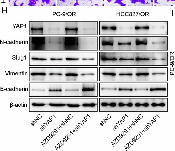 Fig.1.H showing Western Blotting in a Homo sapiens (Human) sample from the publication: Inhibition of BRD4 sensitizes NSCLC cells to osimertinib by suppressing APT1 and promoting MST1 palmitoylation.