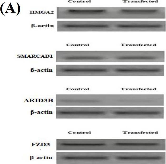 Fig.4.A showing Western Blotting in a Homo sapiens (Human) sample from the publication: Regulatory Effect of let-7f Transfection in Non-Small Cell Lung Cancer on its Candidate Target Genes.