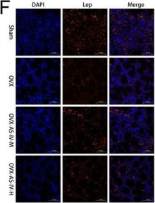 Fig.11.F showing Immunocytochemistry-immunofluorescence from the publication: Astragaloside IV modulates oxidative stress and osteoimmune-Wnt signaling in ovariectomized rats: an integrated study of RNA sequencing, molecular docking, and experimental validation.