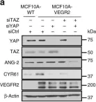 Fig.5.A showing Western Blotting from the publication: A LATS biosensor screen identifies VEGFR as a regulator of the Hippo pathway in angiogenesis.