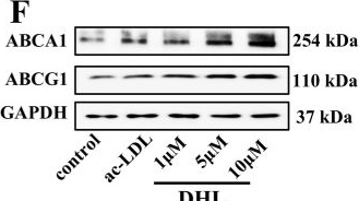 Fig.5.F showing Western Blotting in a Mus musculus (House mouse) sample from the publication: Dehydrocostus lactone attenuates atherogenesis by promoting cholesterol efflux and inhibiting inflammation via TLR2/PPAR-γ/NF-κB signaling pathway.