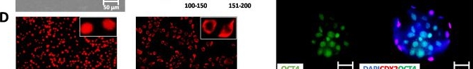 Fig.4.B showing Immunohistochemistry-immunofluorescence in a Homo sapiens (Human) sample from the publication: Combination of epigenetic erasing and mechanical cues to generate human epiBlastoids from adult dermal fibroblasts.