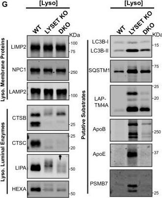 Fig.5.G showing Western Blotting in a Homo sapiens (Human) sample from the publication: Peroxisome-derived ether lipids regulate lysosomal exocytosis.