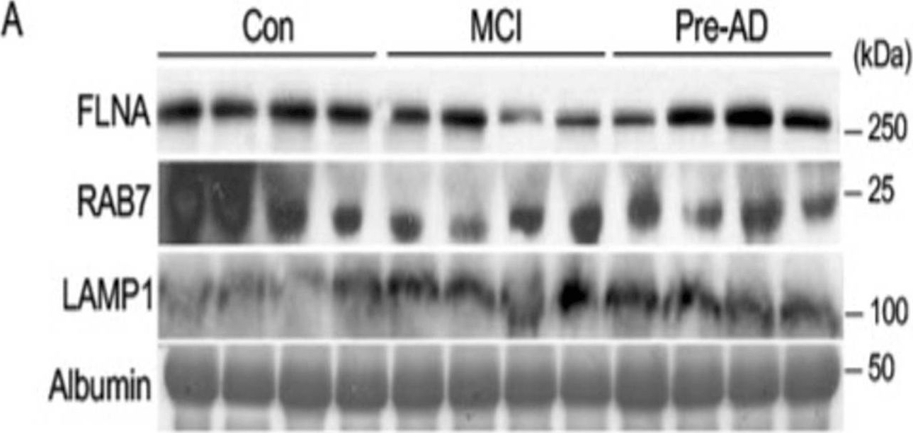 Fig.7.A showing Western Blotting from the publication: Investigating the Pathological Relevance of N-acylsphingosine Amidohydrolase 2 (ASAH2) and Related Proteins in Alzheimer's Disease.