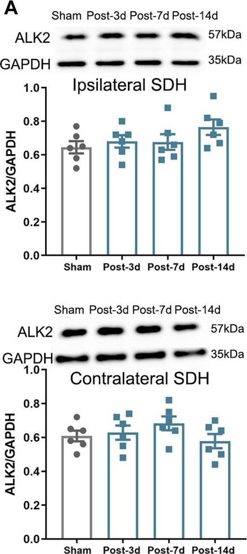 Fig.4.A showing Western Blotting in a Mus musculus (House mouse) sample from the publication: BMP10 accelerated spinal astrocytic activation in neuropathic pain via ALK2/smad1/5/8 signaling.