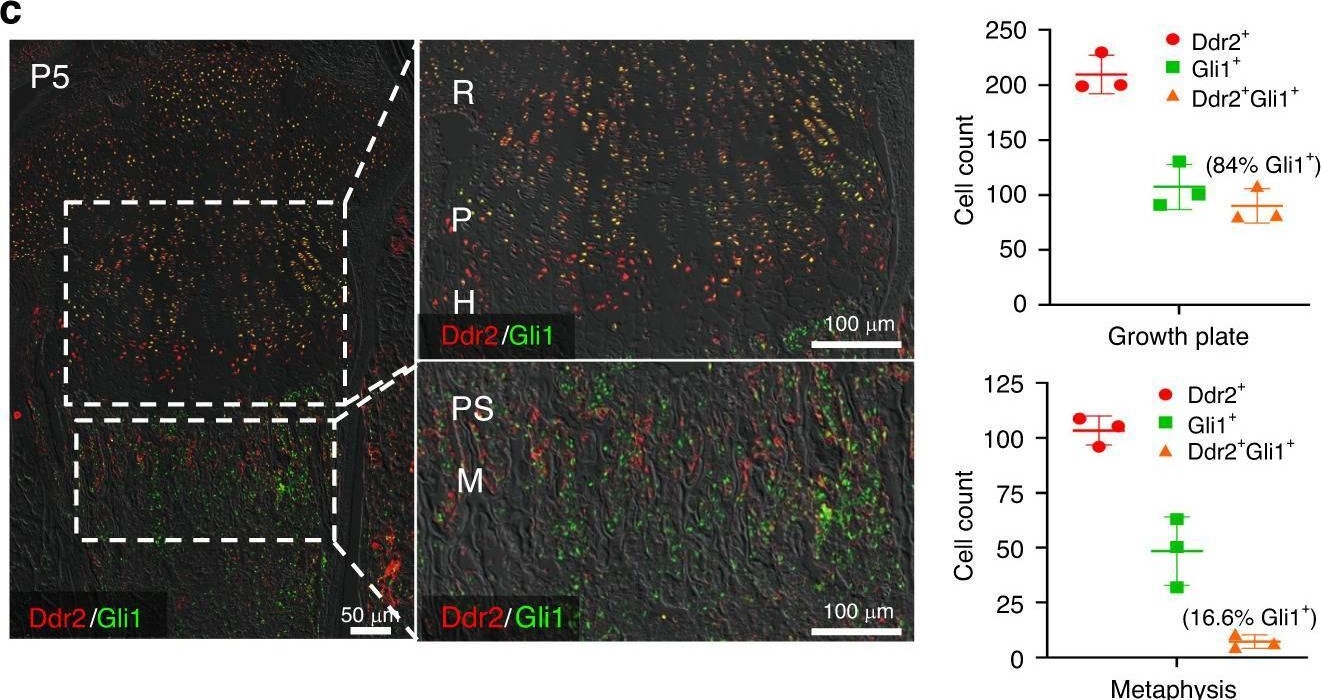 Fig.3.C showing Immunohistochemistry-immunofluorescence from the publication: The collagen receptor, discoidin domain receptor 2, functions in Gli1-positive skeletal progenitors and chondrocytes to control bone development.