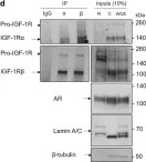 Fig.2.D showing Western Blotting in a Homo sapiens (Human) sample from the publication: IGF-1R nuclear import and recruitment to chromatin involves both alpha and beta subunits.
