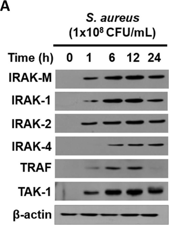 Fig.5.A showing Western Blotting in a Homo sapiens (Human) sample from the publication: Staphylococcus aureus utilizes vimentin to internalize human keratinocytes.