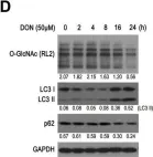 Fig.1.D showing Western Blotting in a Homo sapiens (Human) sample from the publication: Blockage of O-linked GlcNAcylation induces AMPK-dependent autophagy in bladder cancer cells.