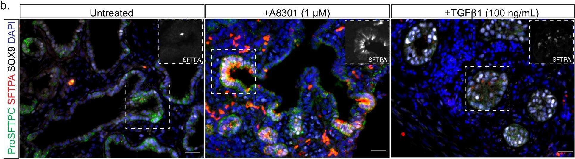 Fig.2.B showing Immunohistochemistry-immunofluorescence from the publication: Opposing roles for TGFβ- and BMP-signaling during nascent alveolar differentiation in the developing human lung.