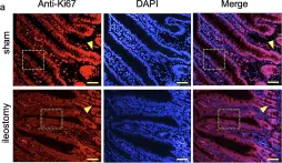 Fig.5.A showing Immunohistochemistry in a Rattus norvegicus (Rat) sample from the publication: A new murine ileostomy model: recycling stool prevents intestinal atrophy in the distal side of ileostomy.