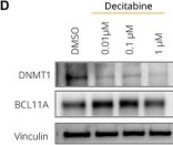 Fig.1.D showing Western Blotting from the publication: Decitabine-Driven Foetal Haemoglobin Induction in Townes Mice and Human Erythroblasts.