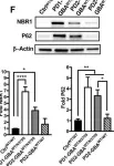 Fig.6.F showing Western Blotting from the publication: Deregulation of mTORC1-TFEB axis in human iPSC model of GBA1-associated Parkinson's disease.