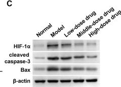 Fig.2.C showing Western Blotting in a Rattus norvegicus (Rat) sample from the publication: β-Sitosterol attenuates obstructive sleep apnea-related myocardial injury via MALAT1-mediated HIF-1α regulation.