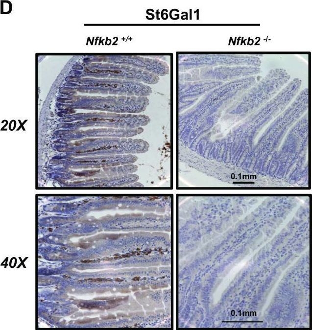Fig.1.D showing Immunohistochemistry in a Mus musculus (House mouse) sample from the publication: Nfkb2 deficiency and its impact on plasma cells and immunoglobulin expression in murine small intestinal mucosa.