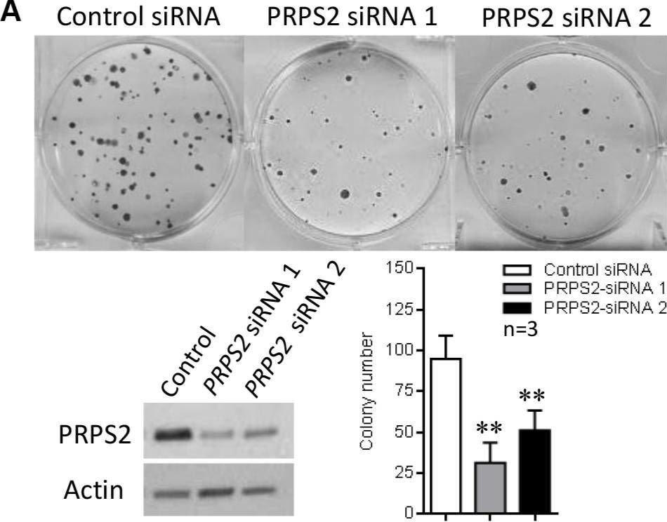 Fig.7.A showing Western Blotting in a Homo sapiens (Human) sample from the publication: MYCN promotes neuroblastoma malignancy by establishing a regulatory circuit with transcription factor AP4.