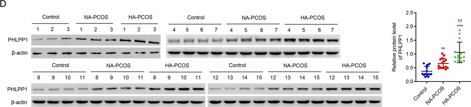 Fig.2.D showing Western Blotting in a Homo sapiens (Human) sample from the publication: PHLPP1 inhibits the growth and aerobic glycolysis activity of human ovarian granular cells through inactivating AKT pathway.
