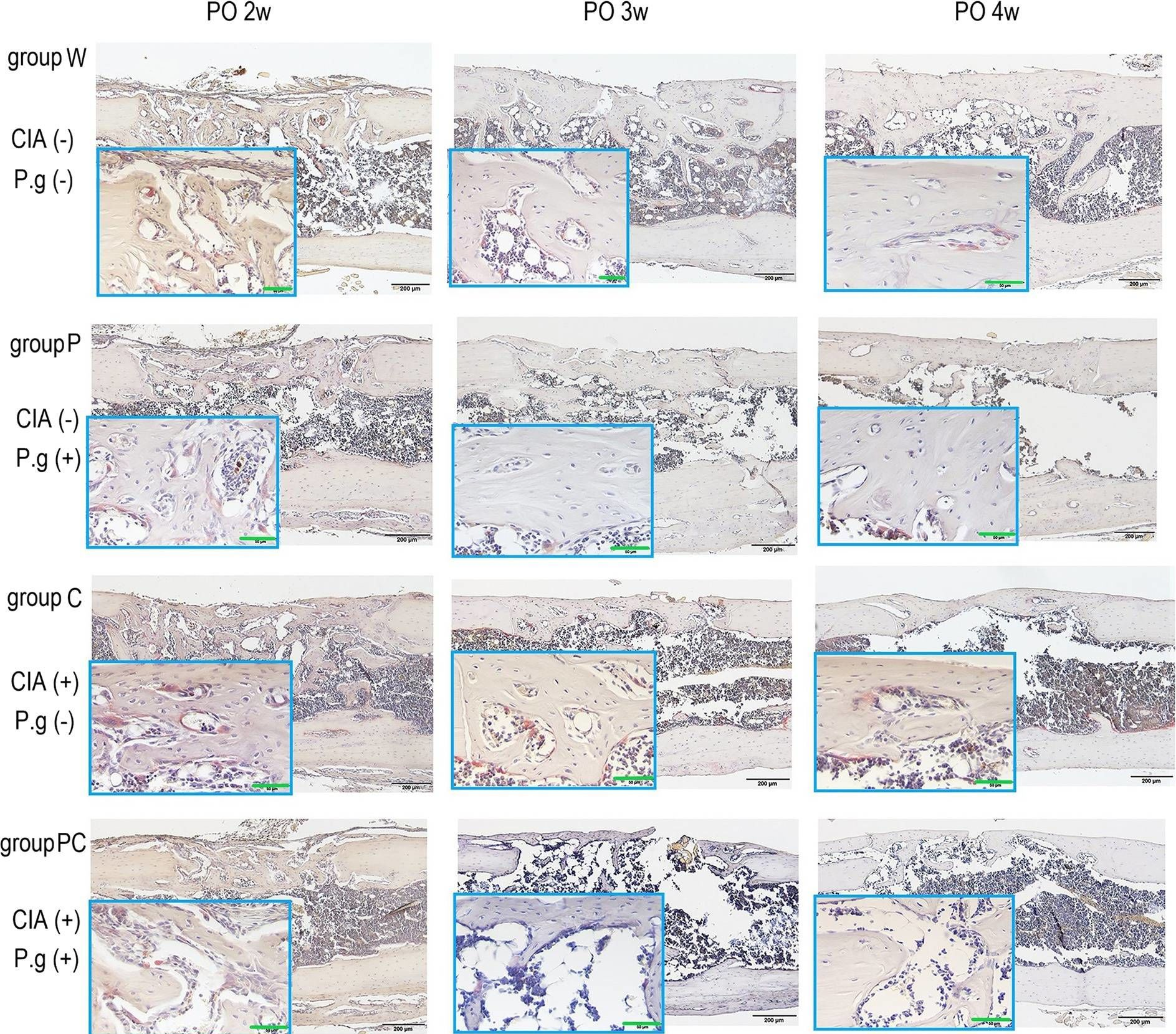 Fig.4.A showing Immunohistochemistry in a Mus musculus (House mouse) sample from the publication: Experimental arthritis and Porphyromonas gingivalis administration synergistically decrease bone regeneration in femoral cortical defects.