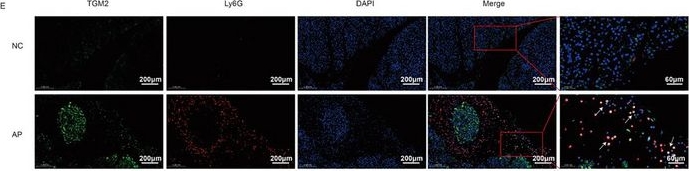 Fig.3.E showing Immunohistochemistry-immunofluorescence in a Mus musculus (House mouse) sample from the publication: TGM2 Aggravates Acute Pancreatitis by Impairing Macrophage Efferocytosis Through Inhibition of the STAT6-GAS6 Axis.