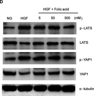 Fig.4.D showing Western Blotting in a Rattus norvegicus (Rat) sample from the publication: Folic Acid Alleviates High Glucose and Fat-Induced Pyroptosis via Inhibition of the Hippo Signal Pathway on H9C2 Cells.