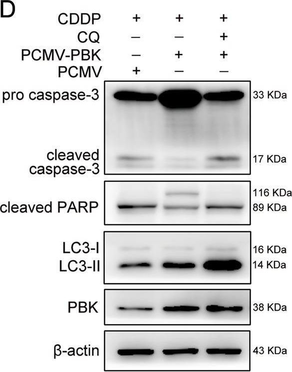 Fig.7.D showing Western Blotting from the publication: PBK, targeted by EVI1, promotes metastasis and confers cisplatin resistance through inducing autophagy in high-grade serous ovarian carcinoma.