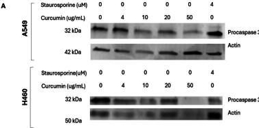 Fig.3.A showing Western Blotting in a Homo sapiens (Human) sample from the publication: Low, plasma level‑informed native curcumin concentrations fail to induce cell death in human lung and colorectal cancer cells.