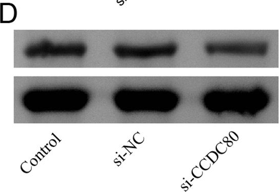 Fig.4.D showing Western Blotting in a Homo sapiens (Human) sample from the publication: Silencing immune-infiltrating biomarker CCDC80 inhibits malignant characterization and tumor formation in gastric cancer.