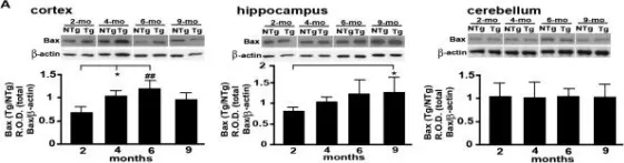 Fig.4.A showing Western Blotting from the publication: The expression of apoptosis inducing factor (AIF) is associated with aging-related cell death in the cortex but not in the hippocampus in the TgCRND8 mouse model of Alzheimer's disease.