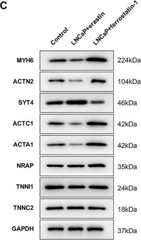 Fig.8.C showing Western Blotting in a Homo sapiens (Human) sample from the publication: Identification of Ferroptosis-Associated Genes in Prostate Cancer by Bioinformatics Analysis.