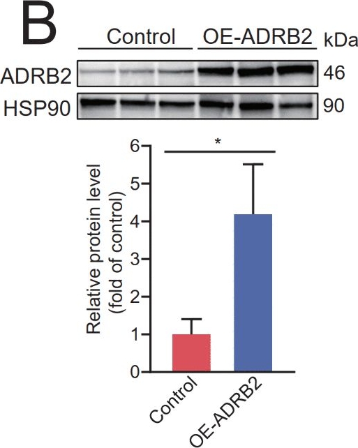 Fig.5.B showing Western Blotting in a Mus musculus (House mouse) sample from the publication: C1RL-AS1/microRNA-424-5p/adrenoceptor β2 axis: A novel regulatory mechanism in lung adenocarcinoma associated with immune infiltration and prognosis.