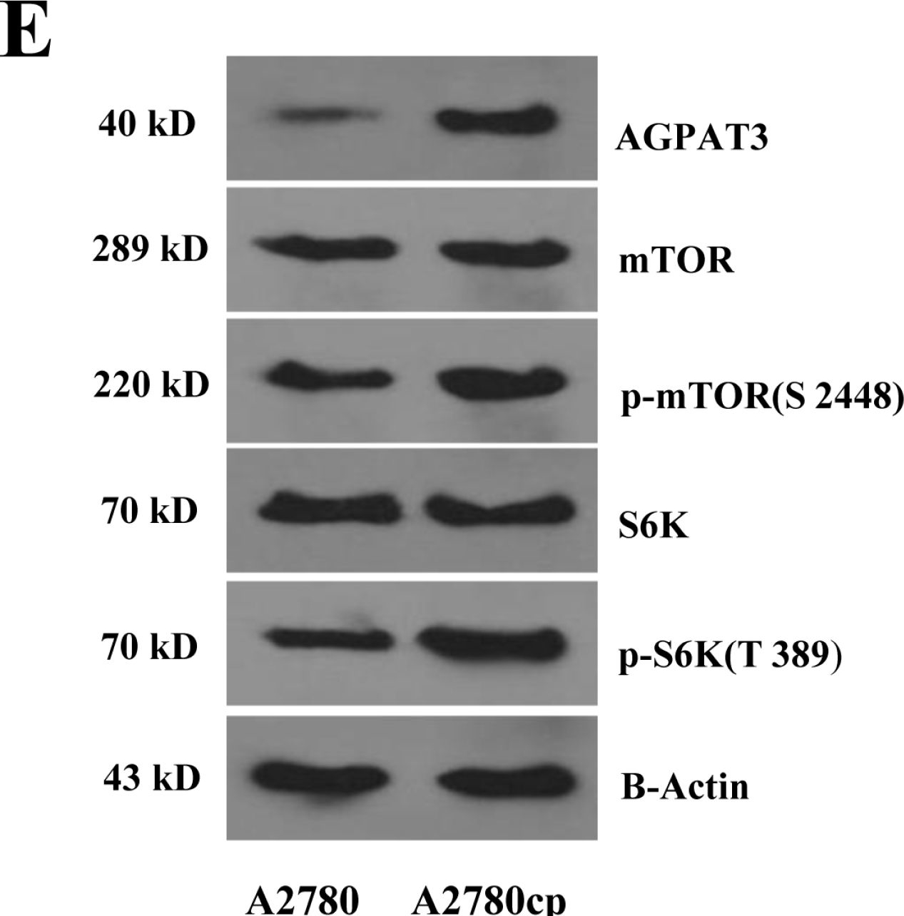 Fig.2.E showing Western Blotting in a Homo sapiens (Human) sample from the publication: Introduction of AGPAT3 gene as a regulator of cisplatin resistance in A2780 ovarian endometrioid carcinoma cell line.