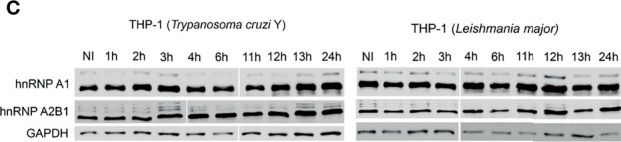 Fig.2.C showing Western Blotting in a Trypanosoma cruzi sample from the publication: Modulation of the Host Nuclear Compartment by Trypanosoma cruzi Uncovers Effects on Host Transcription and Splicing Machinery.