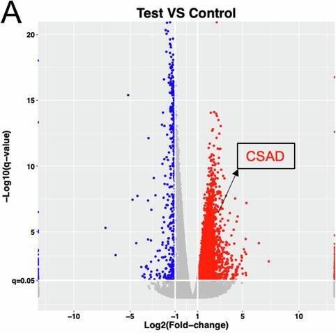 Fig.5.A showing Flow cytometry/Cell sorting from the publication: RBM17 promotes hepatocellular carcinoma progression by regulating lipid metabolism and immune microenvironment: implications for therapeutic targeting.