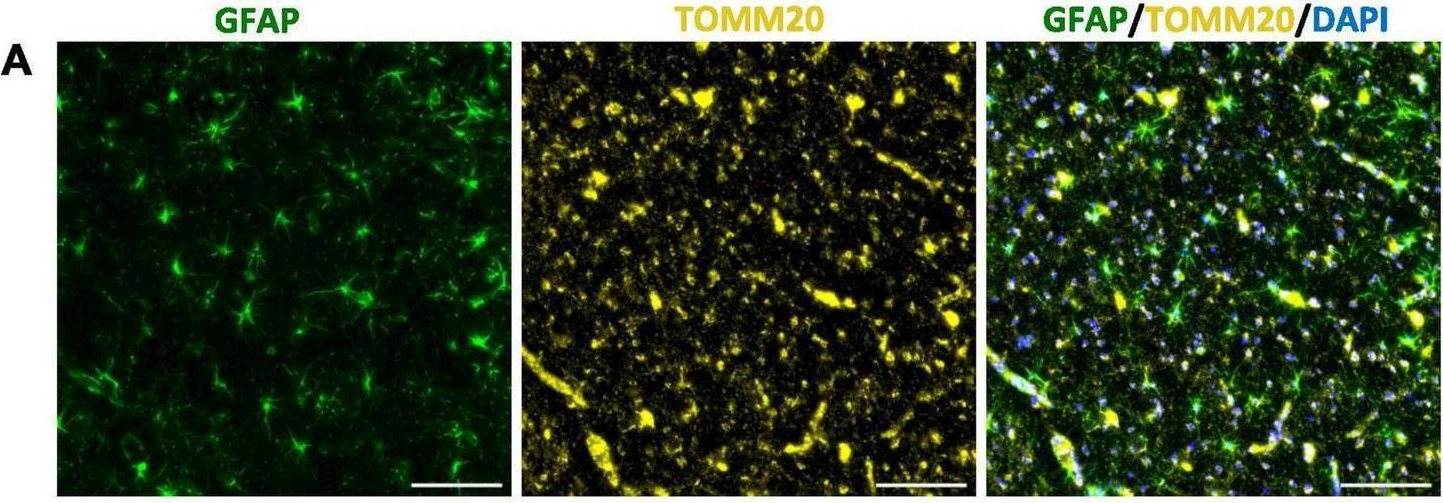 Fig.1.A showing Immunohistochemistry-immunofluorescence in a Cystophora cristata (Hooded seal) sample from the publication: Potential for flexible lactate shuttling between astrocytes and neurons to mitigate against diving-induced hypoxia.
