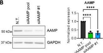 Fig.3.B showing Western Blotting in a Homo sapiens (Human) sample from the publication: AAMP and MTSS1 Are Novel Negative Regulators of Endothelial Barrier Function Identified in a Proteomics Screen.