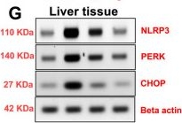 Fig.4.G showing Western Blotting in a Rattus norvegicus (Rat) sample from the publication: Oridonin attenuates diclofenac-induced organ damage by suppressing endoplasmic reticulum stress and inflammasome activation.