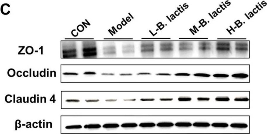 Fig.3.C showing Western Blotting in a Mus musculus (House mouse) sample from the publication: Bifidobacterium animalis Subsp. lactis PB200 Improves Intestinal Barrier Function and Flora Disturbance in Mice with Antibiotic-Induced Intestinal Injury.