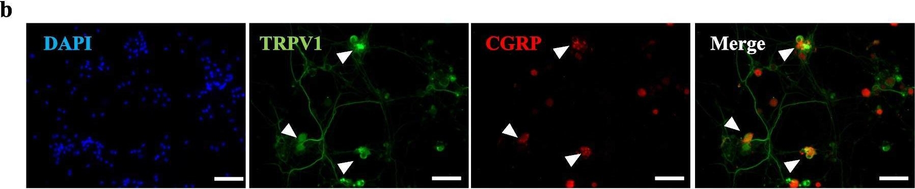 Fig.4.B showing Immunohistochemistry-immunofluorescence in a Mus musculus (House mouse) sample from the publication: TRPV1+ neurons alter Staphylococcus aureus skin infection outcomes by affecting macrophage polarization and neutrophil recruitment.