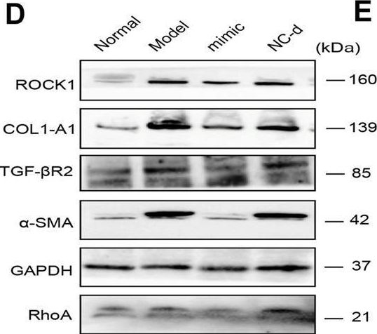 Fig.6.D showing Western Blotting from the publication: Ferulic Acid Combined With Bone Marrow Mesenchymal Stem Cells Attenuates the Activation of Hepatic Stellate Cells and Alleviates Liver Fibrosis.