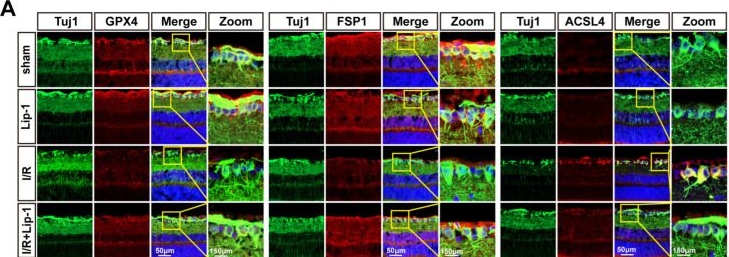 Fig.3.A showing Immunocytochemistry-immunofluorescence in a Mus musculus (House mouse) sample from the publication: Liproxstatin-1 Attenuates Retinal Ischemia-Reperfusion Injury by Suppressing EGR1-Mediated Ferroptosis.