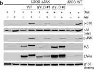 Fig.5.B showing Western Blotting in a Homo sapiens (Human) sample from the publication: Computational and Functional Analysis of Structural Features in the ZAKα Kinase.