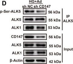 Fig.5.D showing Western Blotting from the publication: N-glycosylation-mediated CD147 accumulation induces cardiac fibrosis in the diabetic heart through ALK5 activation.