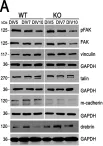 Fig.3.A showing Western Blotting from the publication: Formation of Aberrant Myotubes by Myoblasts Lacking Myosin VI Is Associated with Alterations in the Cytoskeleton Organization, Myoblast Adhesion and Fusion.