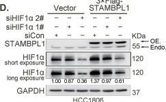 ローチェ　M Anti HIF-1 Alpha Antibody (D1S7W) Rabbit mAb | Cell